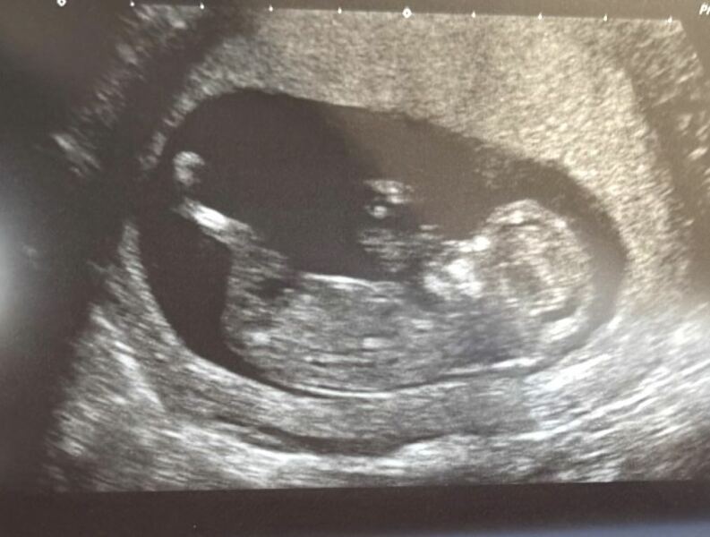Due January 2026 ✨