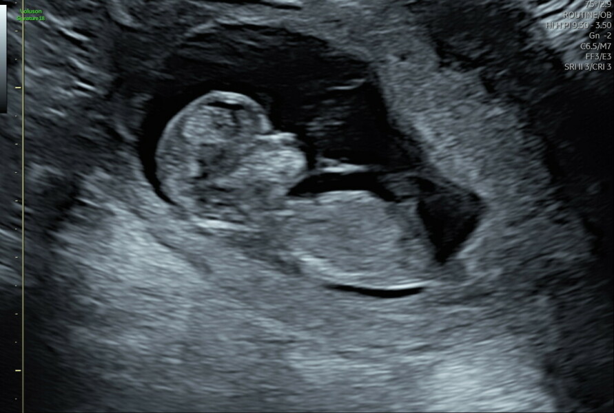 Due January 2026 ✨