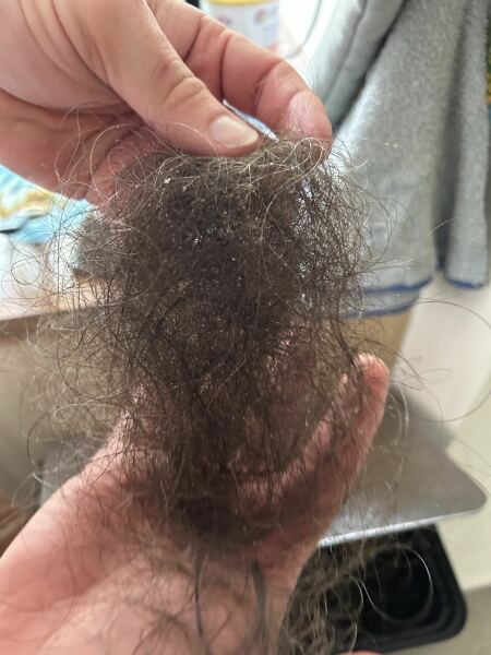 Losing this much hair now baby is 9 months (pic)