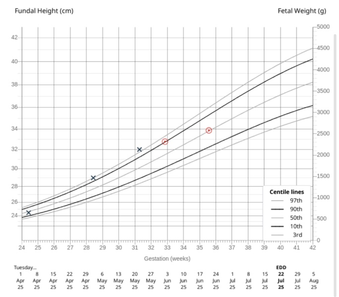 40% drop in centile at growth scan