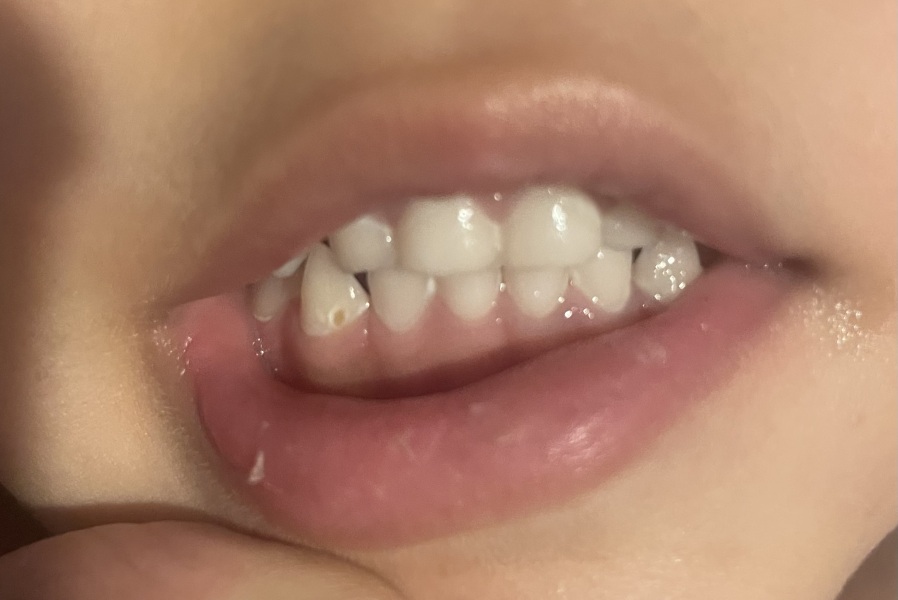 Can any dentists help me please?