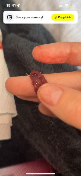 Help - possible miscarriage [content warning: contains graphic image] Title edited by MNHQ