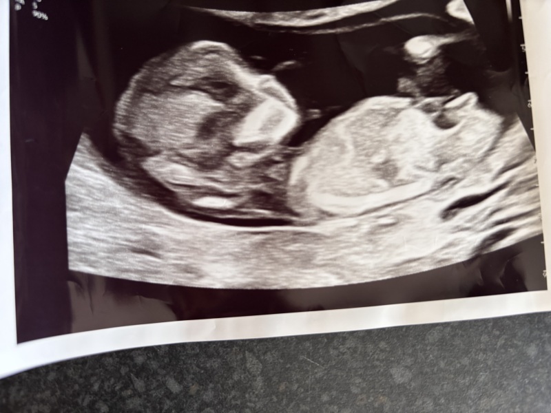 Due February 2025 - Thread 3