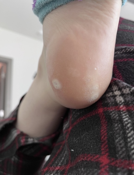 What are these called? Had them most of my childhood.