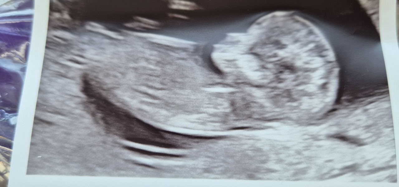 Gender Guesses?