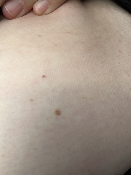 Mole