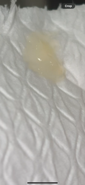 Mucus plug?