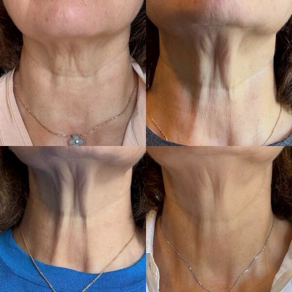 January 2025 Starters Thread 9!