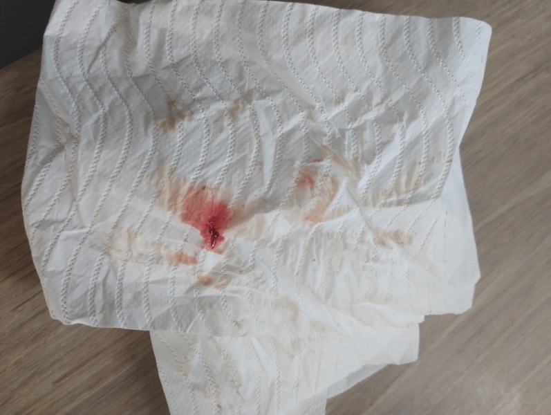 TW blood (possible miscarriage)