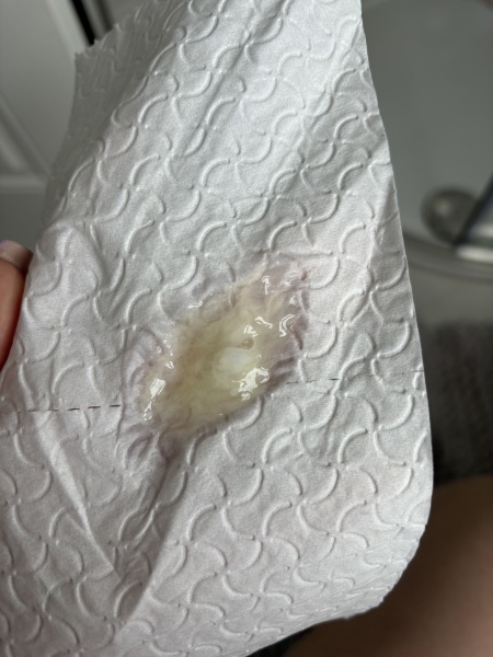 Normal discharge or not ?