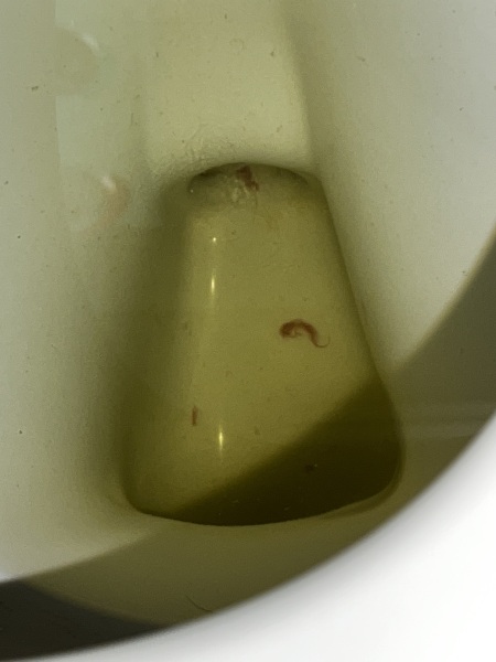 Implantation? Clots?