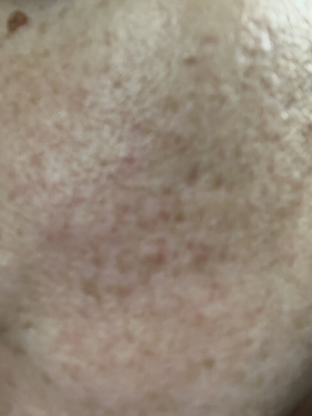 Skin, where to start