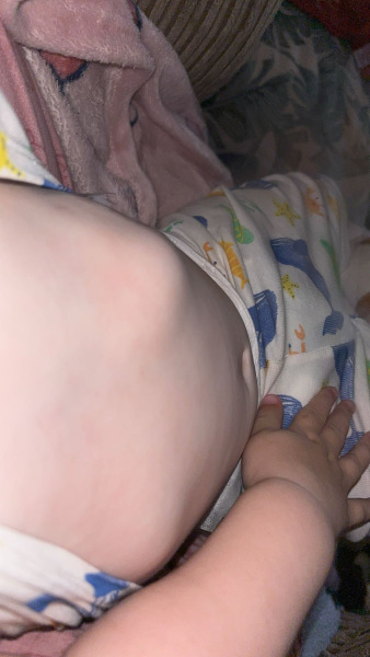 Anyone else’s child’s ribs like this?