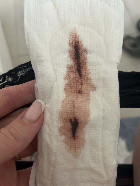 Is this possible implantation? Pic attached