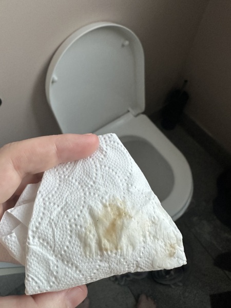Discharge!! Loss of symptoms, advice please!