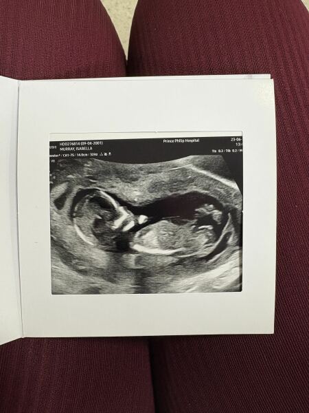 Due January 2026 ✨