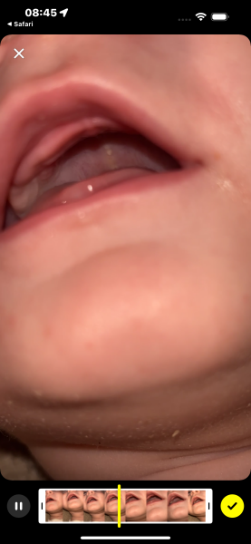 Is this Epstein pearls ?