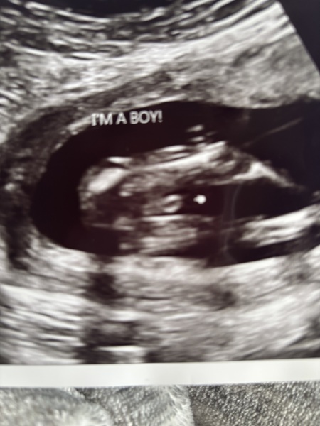 Sex scan at 16+4