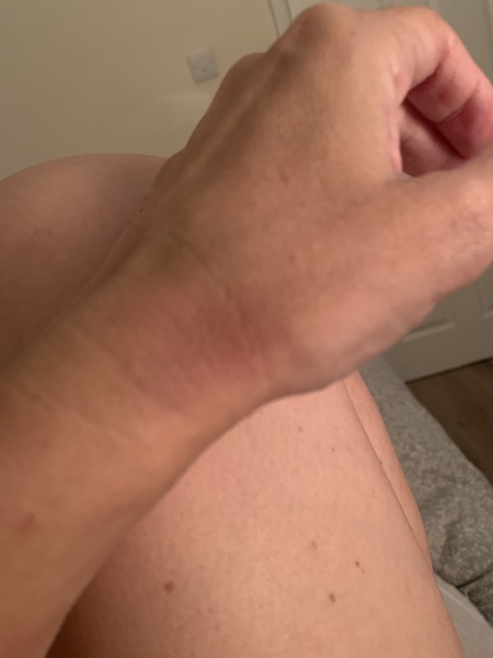 Really worried, grateful of opinions please!