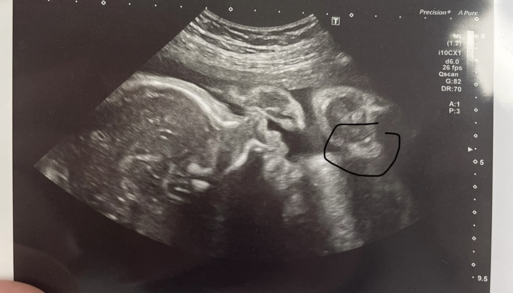 Boy? Is this the Willy?
