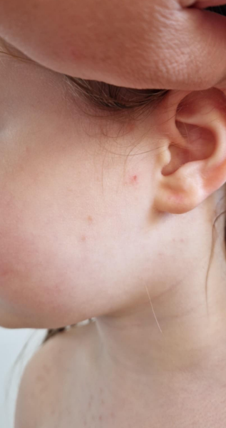 Does this look like a heat rash?
