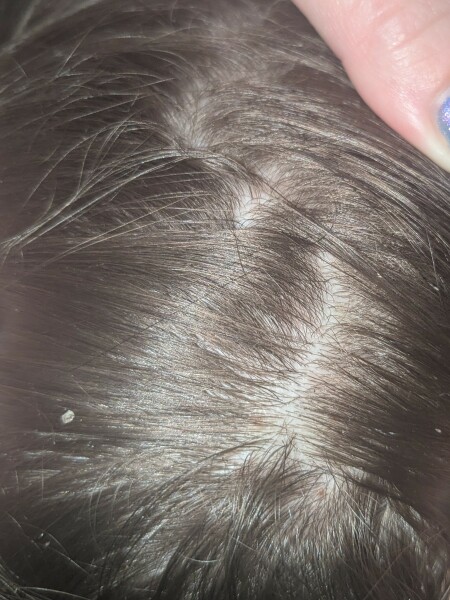 Id this nits?