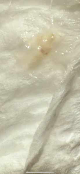 Is this implantation TW Graphic image