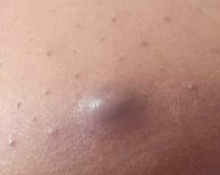 What is this on my boob?!