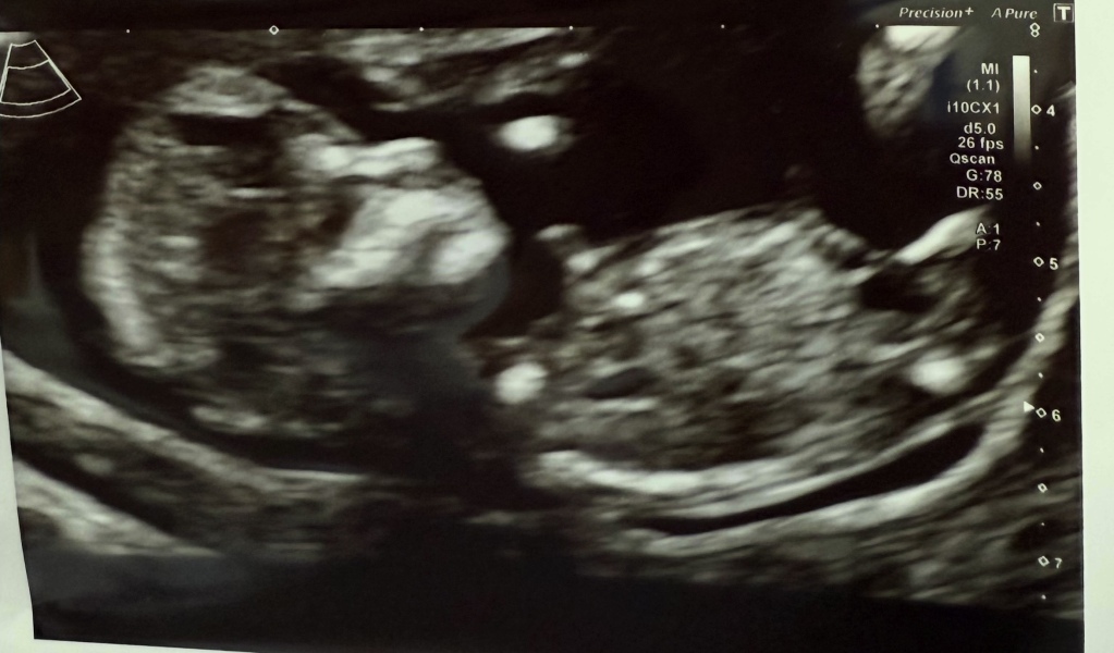 Gender Guess: