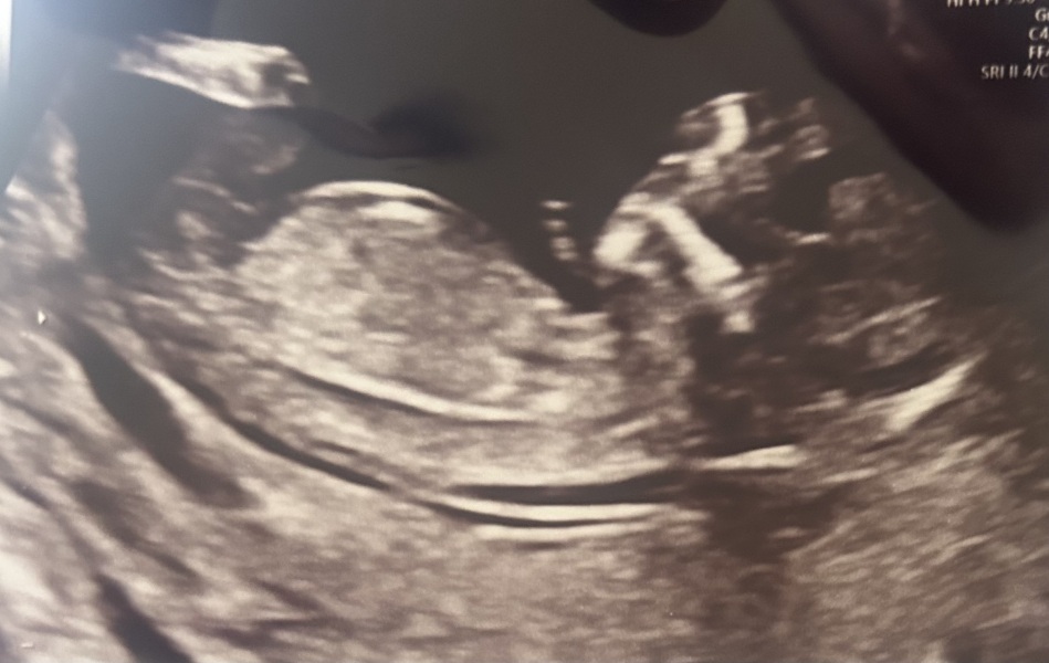 Boy or girl gender guesses 12+4