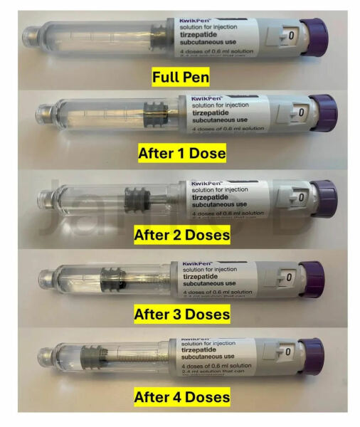 Did I inject it?