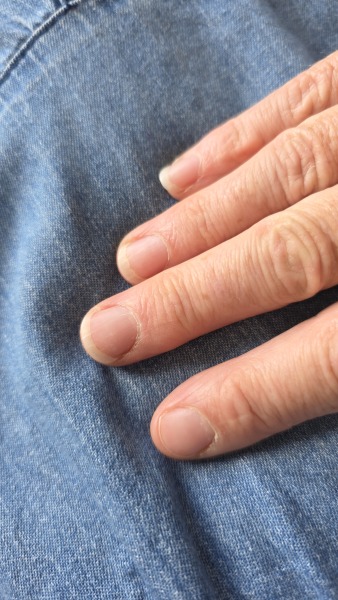 I need a miracle cure for my poor nails