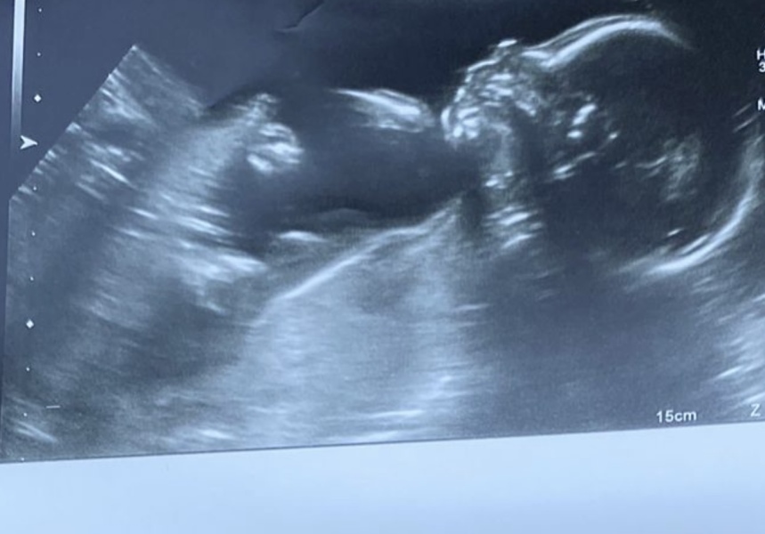 Gender guesses??
