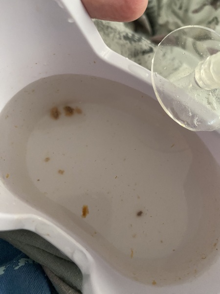 Who wants to see what came from my ear?