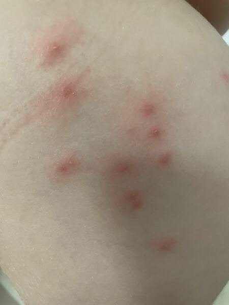 What are these spots on my DD?