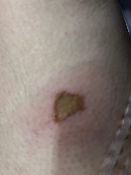 Does this look infected ?  Image included