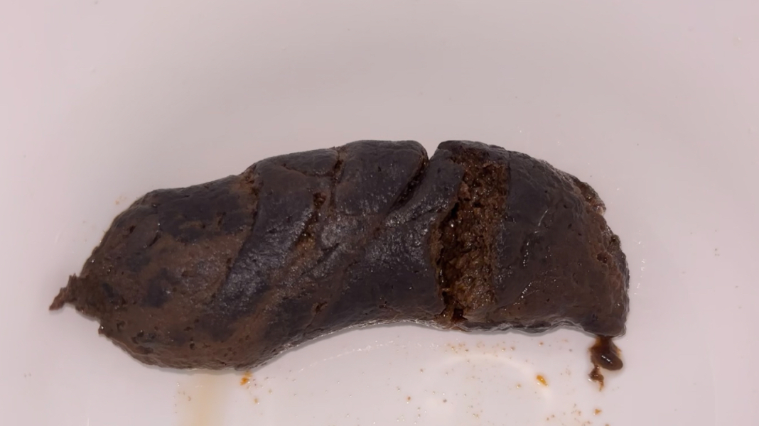 Toddler poo looking very dark brown?