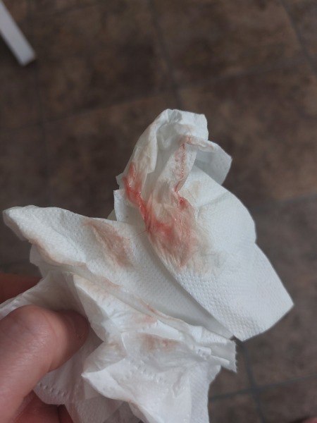 implementation bleeding or period