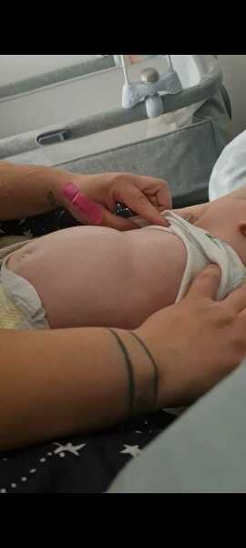 Baby breathing, subcostal retractions :(