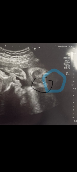 Boy? Is this the Willy?