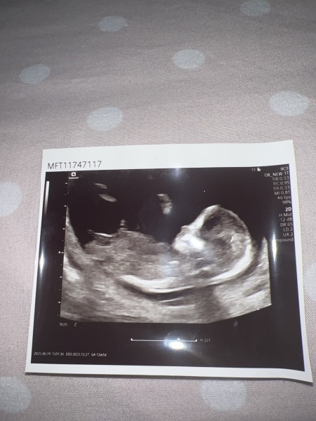 Boy or girl (any guesses)