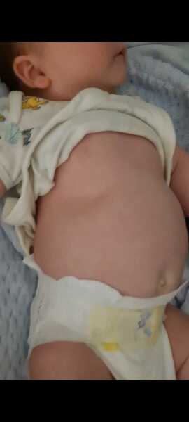 Baby breathing, subcostal retractions :(