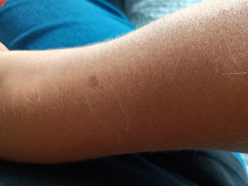 Would you get this checked out?