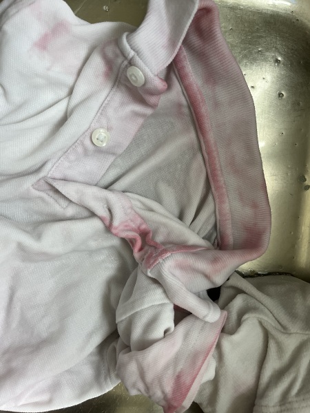 Whites stain removal