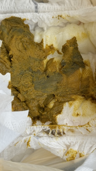 Baby poo… dehydration?