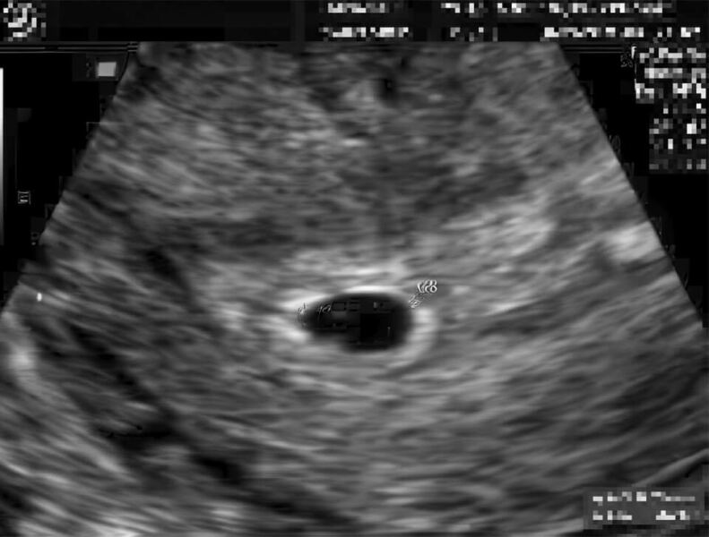 Due February 2026 ✨