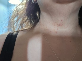 Kitten "Nursing" on my Neck