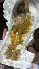 Normal nappy? trigger warning poo pic in message*