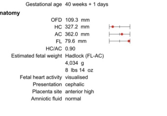 Freaking out! 40+1 scan - head small and OFD seems to have gone down?