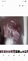 Gender guesses 21 week scan